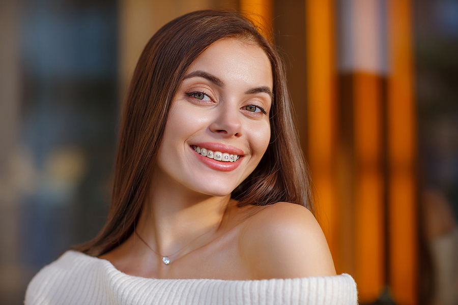 How long does it take to get straight teeth with braces?